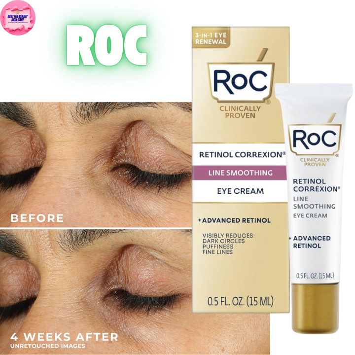 Best Eye Creams for Dark Circles